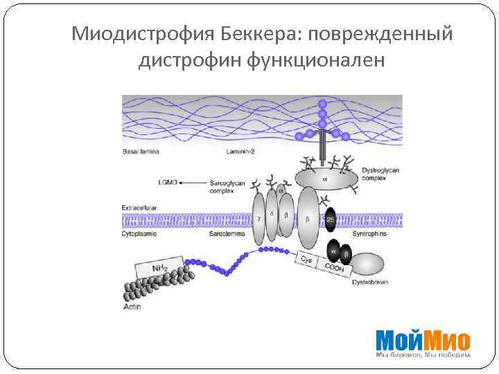 Миодистрофия Беккера: поврежденный дистрофин функционален 