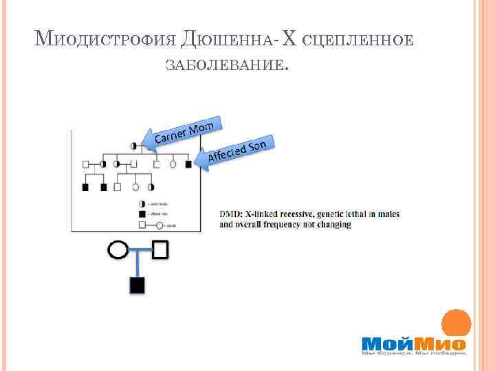 МИОДИСТРОФИЯ ДЮШЕННА- Х СЦЕПЛЕННОЕ ЗАБОЛЕВАНИЕ. 