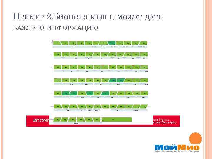 ПРИМЕР 2. БИОПСИЯ МЫШЦ МОЖЕТ ДАТЬ ВАЖНУЮ ИНФОРМАЦИЮ 