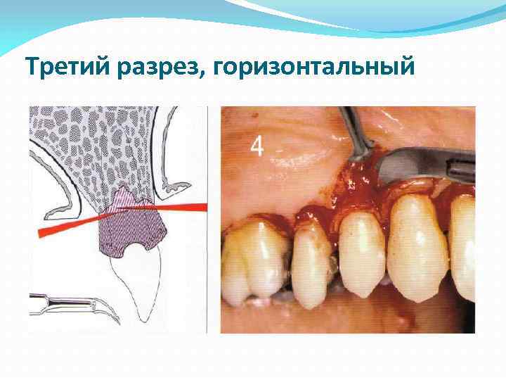 Третий разрез, горизонтальный 