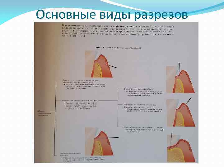 Основные виды разрезов 