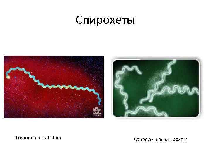 Спирохеты Treponema pallidum Сапрофитная сипрохета 