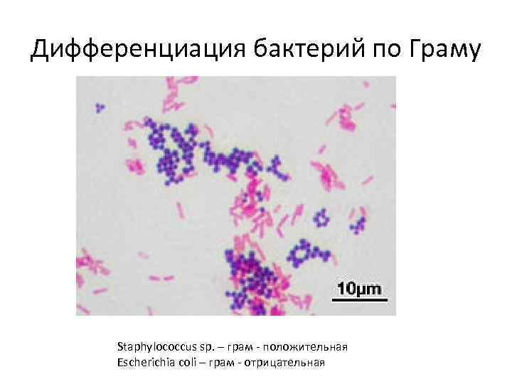 Морфология и систематика микроорганизмов презентация