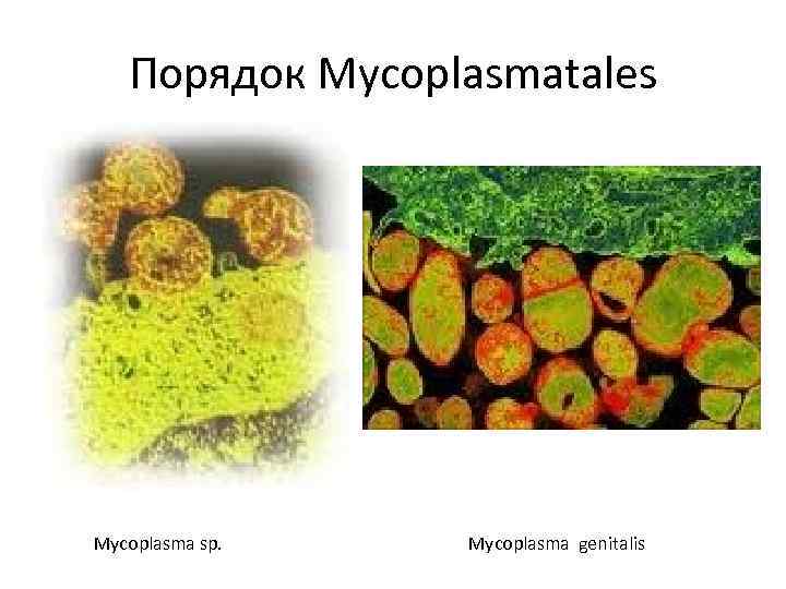 Порядок Mycoplasmatales Mycoplasma sp. Mycoplasma genitalis 