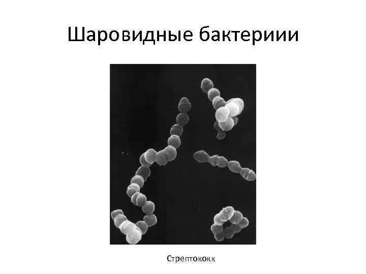 Шаровидные бактериии Стрептококк 