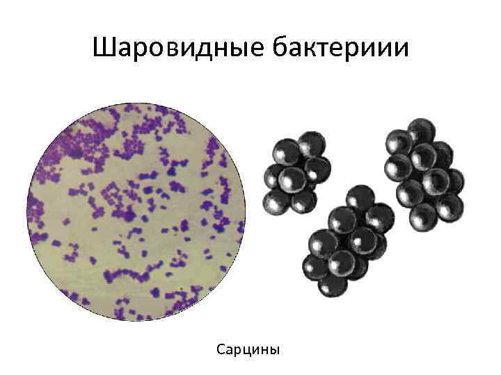 Шаровидные бактериии Сарцины 