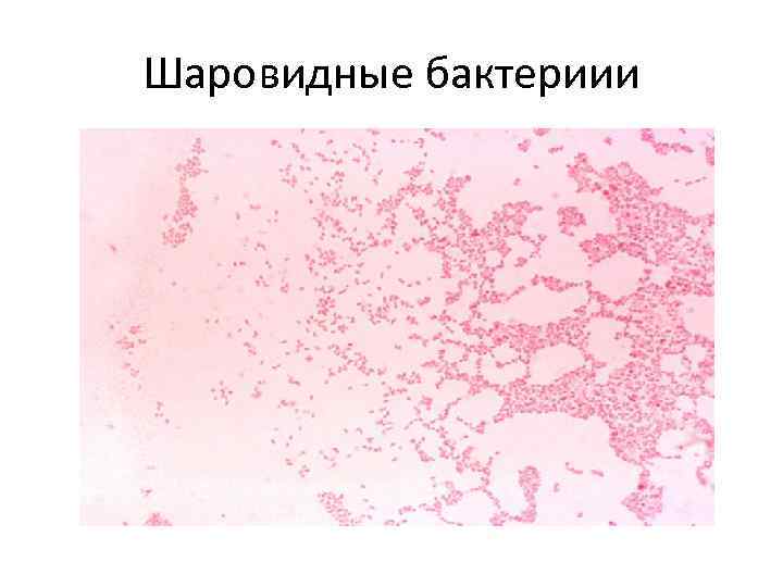 Шаровидные бактериии 