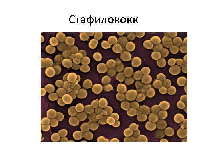 Стафилококк 