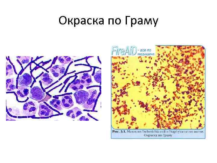 Окраска по Граму 