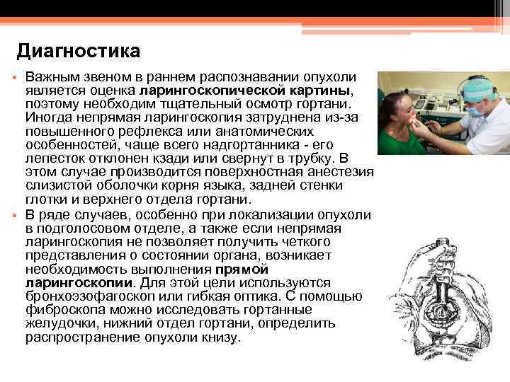 Диагностика • Важным звеном в раннем распознавании опухоли является оценка ларингоскопической картины, поэтому необходим