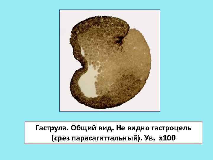 Гаструла. Общий вид. Не видно гастроцель (срез парасагиттальный). Ув. х100 