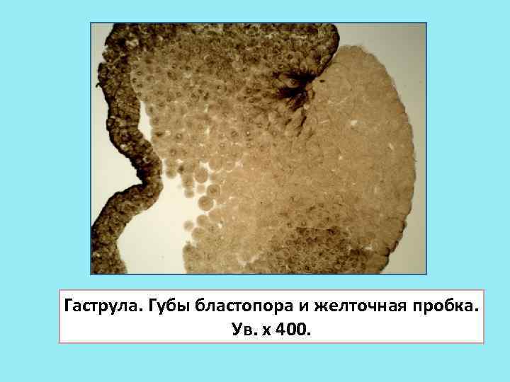 Гаструла. Губы бластопора и желточная пробка. Ув. х 400. 
