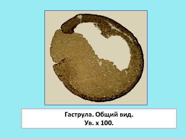 Гаструла картинка с подписями