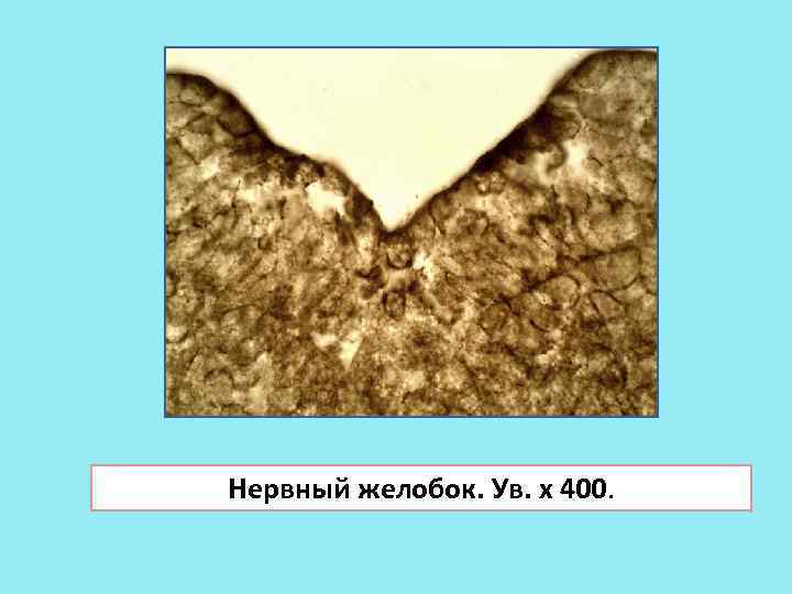 Нервный желобок. Ув. х 400. 