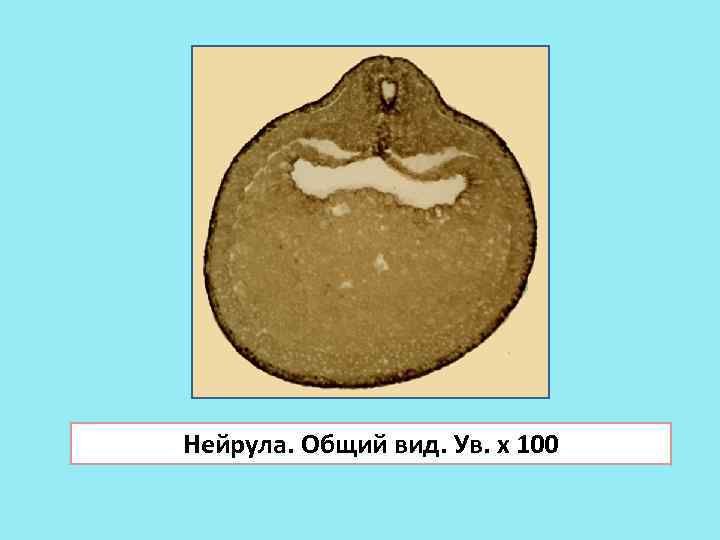 Нейрула. Общий вид. Ув. х 100 