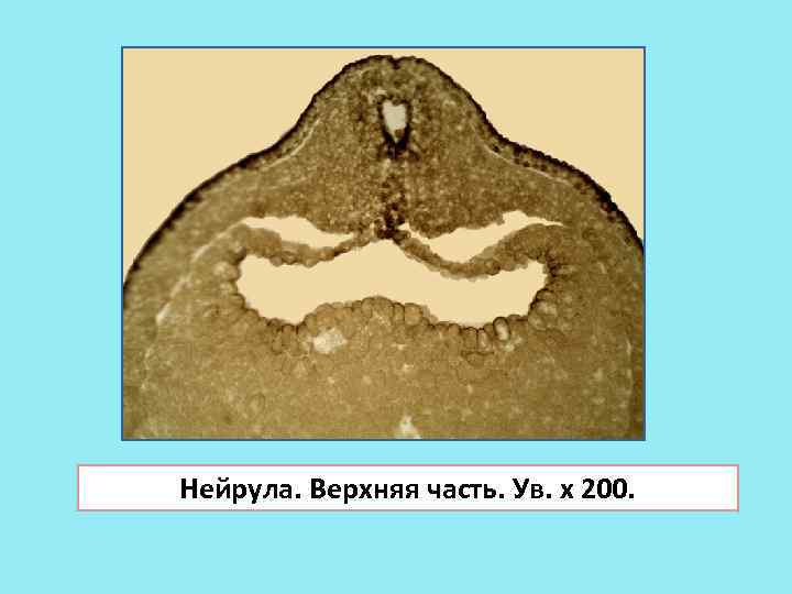 Нейрула. Верхняя часть. Ув. х 200. 