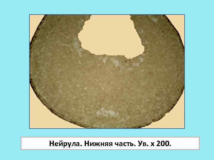 Нейрула. Нижняя часть. Ув. х 200. 