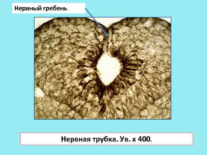 Нервный гребень Нервная трубка. Ув. х 400. 