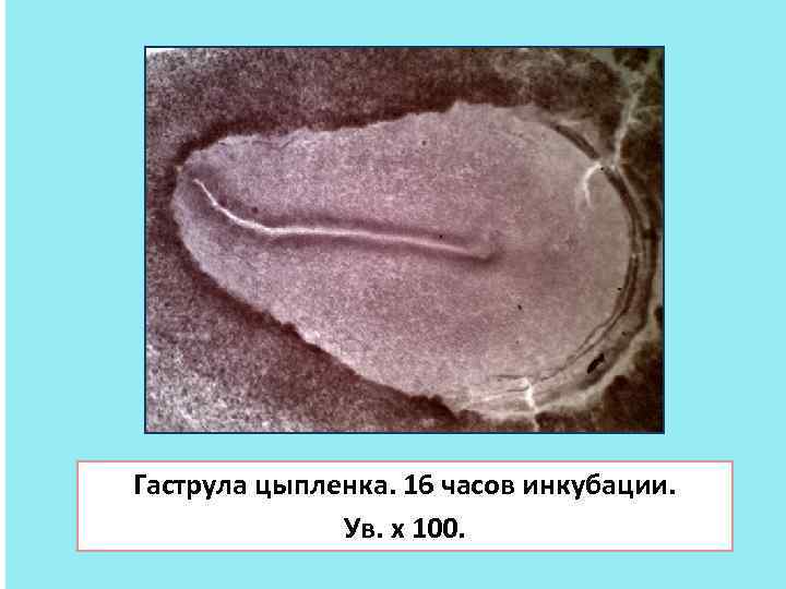 Гаструла цыпленка. 16 часов инкубации. Ув. х 100. 