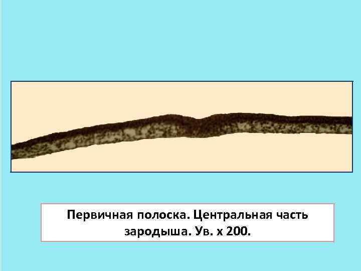 Первичная полоска. Центральная часть зародыша. Ув. х 200. 