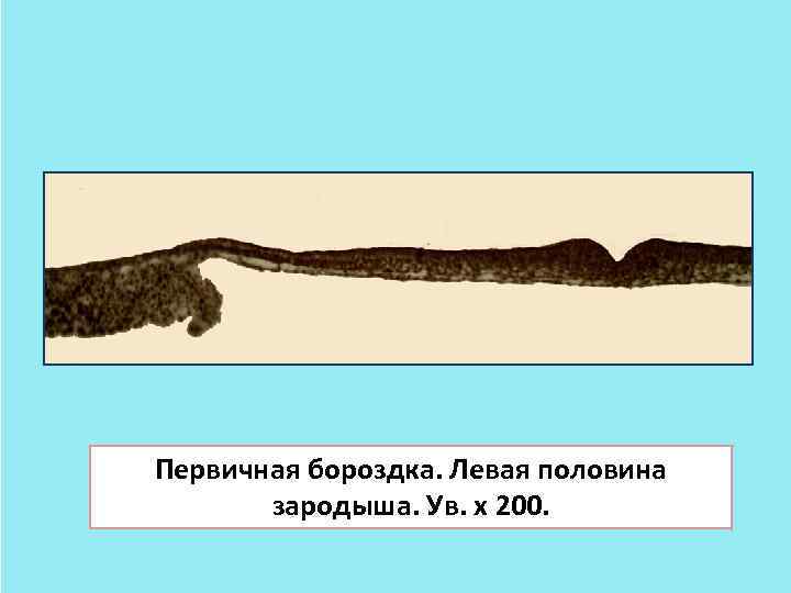 Первичная бороздка. Левая половина зародыша. Ув. х 200. 