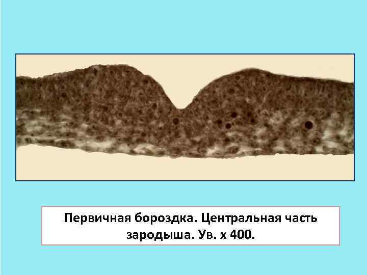 Первичная бороздка. Центральная часть зародыша. Ув. х 400. 
