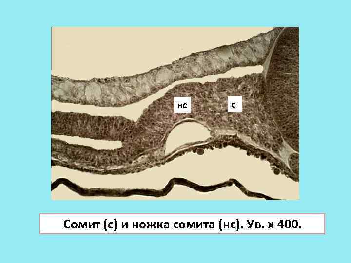 нс с Сомит (с) и ножка сомита (нс). Ув. х 400. 