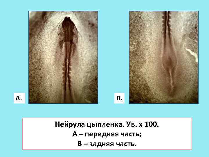 А. В. Нейрула цыпленка. Ув. х 100. А – передняя часть; В – задняя