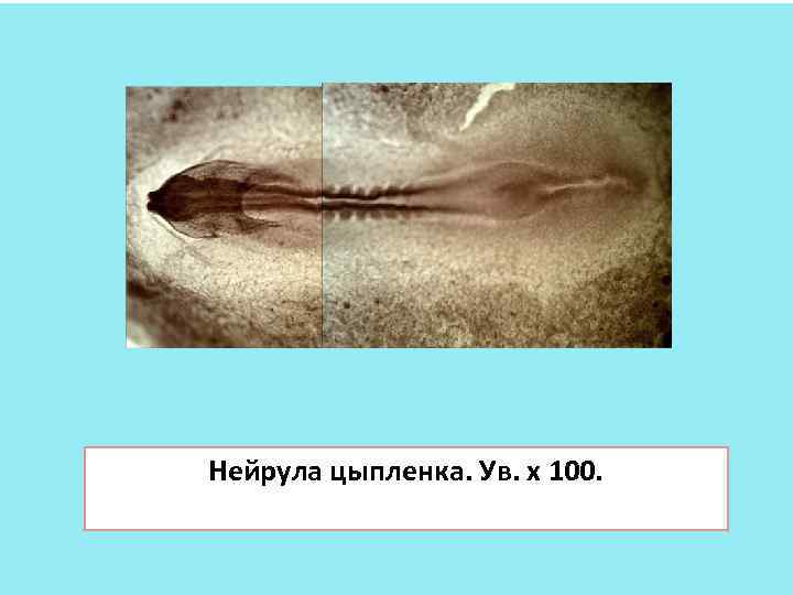 Нейрула цыпленка. Ув. х 100. 