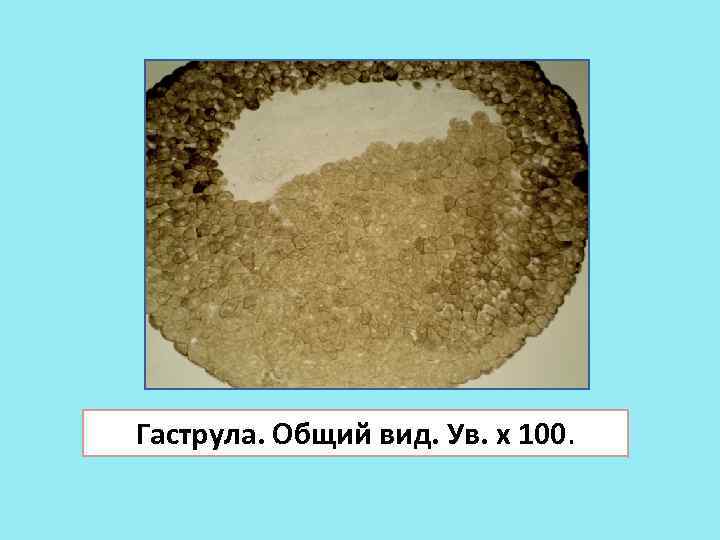 Гаструла. Общий вид. Ув. х 100. 