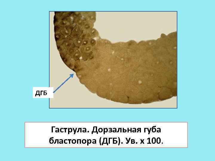 Гаструла лягушки рисунок