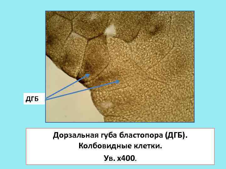 ДГБ Дорзальная губа бластопора (ДГБ). Колбовидные клетки. Ув. х400. 