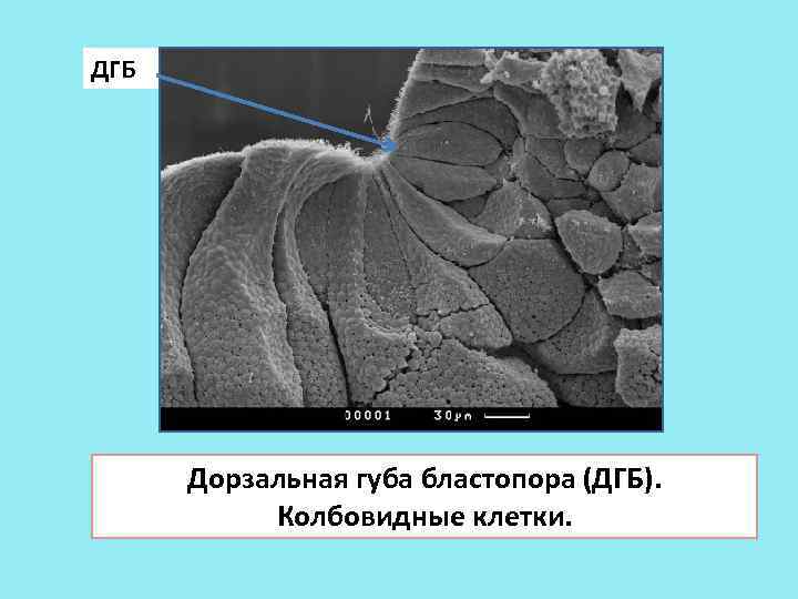 ДГБ Дорзальная губа бластопора (ДГБ). Колбовидные клетки. 