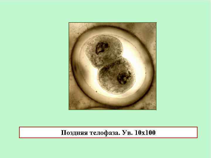Поздняя телофаза. Ув. 10 х100 