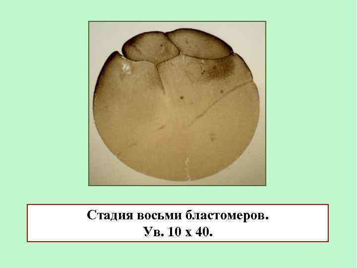 Стадия восьми бластомеров. Ув. 10 х 40. 