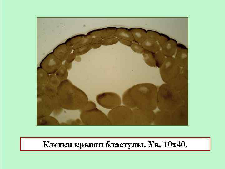 Клетки крыши бластулы. Ув. 10 х40. 