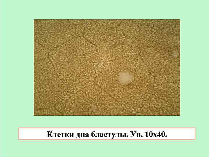Клетки дна бластулы. Ув. 10 х40. 