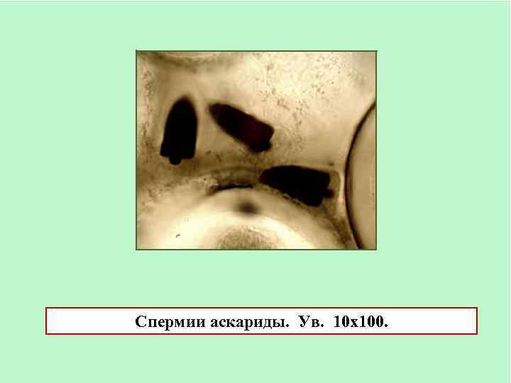 Спермии аскариды. Ув. 10 х100. 
