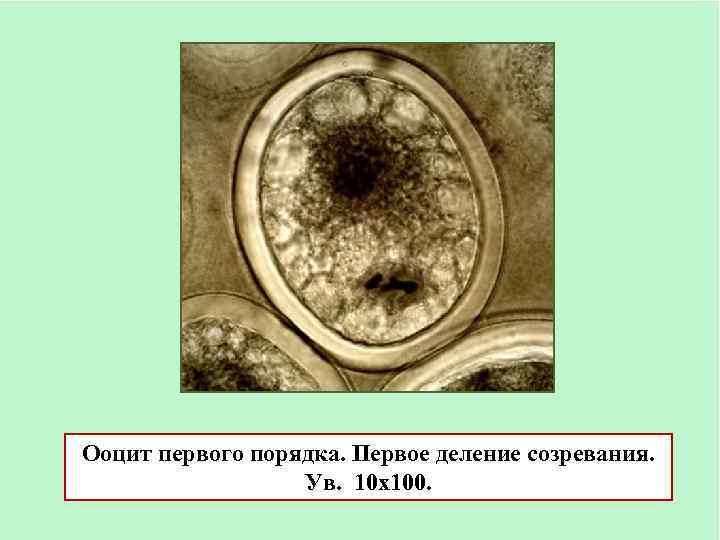 Ооциты деление. Деления созревания яйцеклетки аскариды. Ооциты первого порядка гистология. Ооцит второго порядка. Ооцит 1 порядка и ооцит 2 порядка.