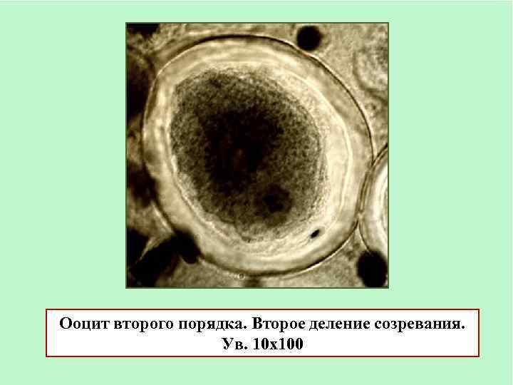 Ооциты качество