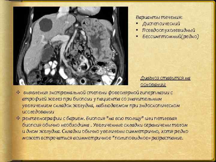 Варианты течения: • Диспепсический • Псевдоопухолевидный • Бессимптомный(редко) Диагноз ставится на основании: ² выявления
