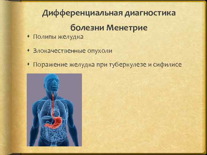 Дифференциальная диагностика болезни Менетрие Полипы желудка Злокачественные опухоли Поражение желудка при туберкулезе и сифилисе