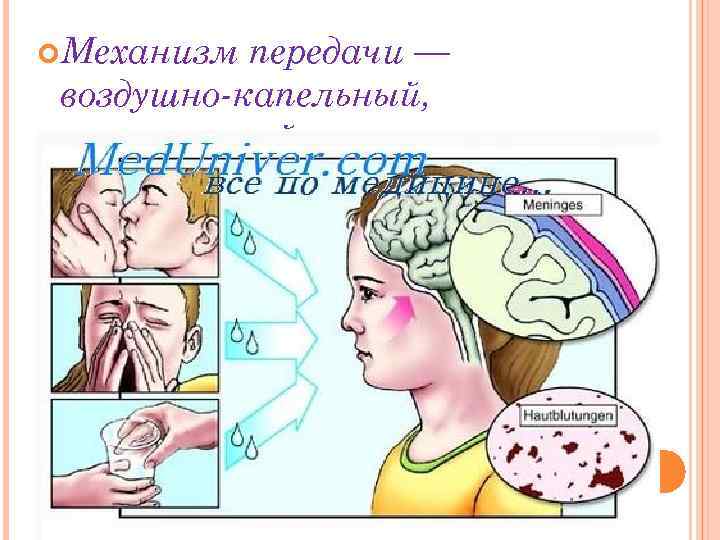 Воздушно капельный менингит. Тифобациллез Ландузи туберкулезный сепсис. Острейший туберкулезный сепсис. Генерализованная форма туберкулеза. Пятна Труссо при туберкулезе.