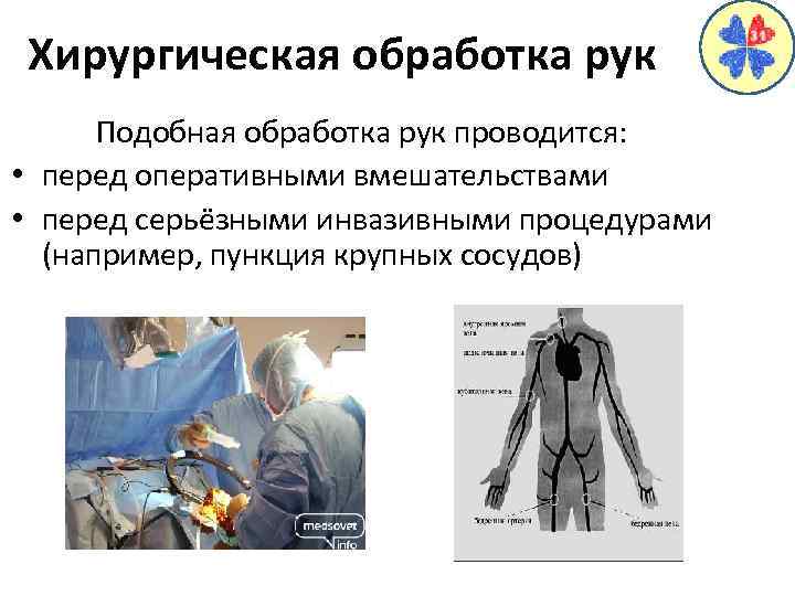 Хирургическая обработка рук Подобная обработка рук проводится: • перед оперативными вмешательствами • перед серьёзными