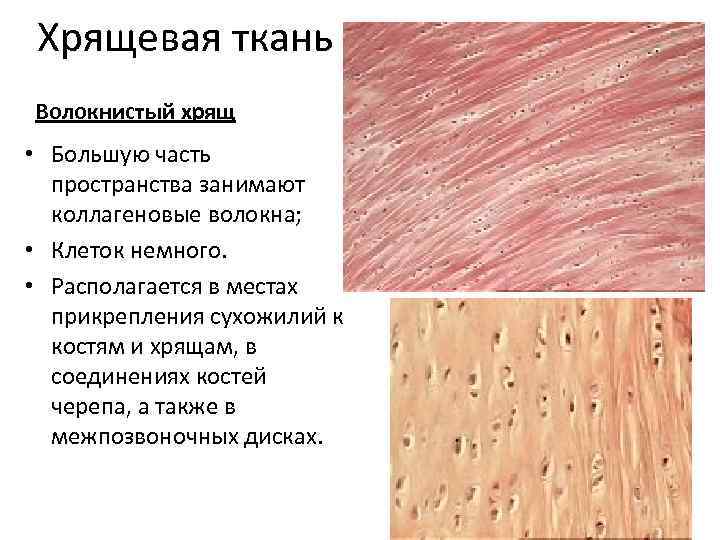 Волокнистый хрящ фото