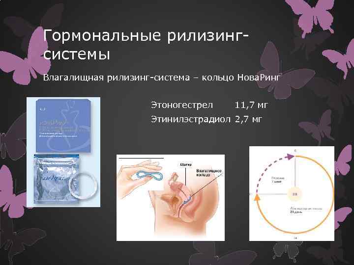 Гормональные рилизинг системы Влагалищная рилизинг система – кольцо Нова. Ринг Этоногестрел 11, 7 мг