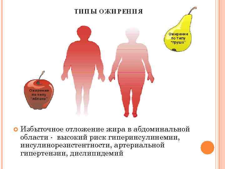  Избыточное отложение жира в абдоминальной области - высокий риск гиперинсулинемии, инсулинорезистентности, артериальной гипертензии,