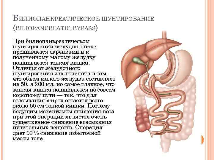 БИЛИОПАНКРЕАТИЧЕСКОЕ ШУНТИРОВАНИЕ (BILIOPANCREATIC BYPASS) При билиопанкреатическом шунтировании желудок также прошивается скрепками и к полученному