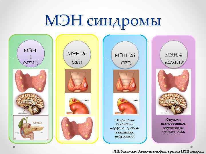 МЭН синдромы МЭН 1 (MEN 1) МЭН-2 а (RET) МЭН-2 б (RET) Невриномы слизистых,
