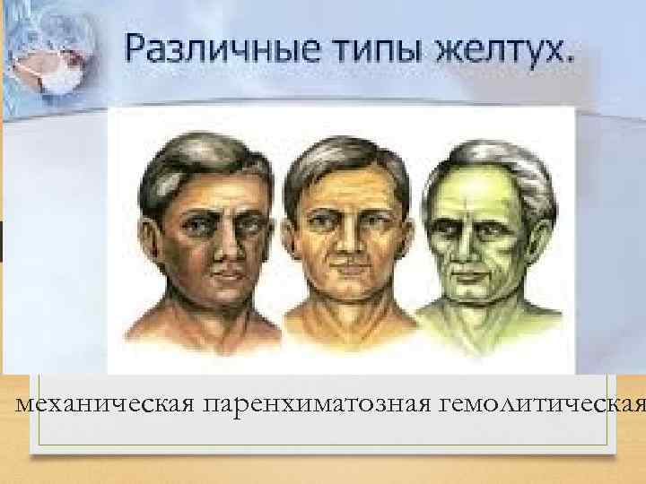 механическая паренхиматозная гемолитическая 